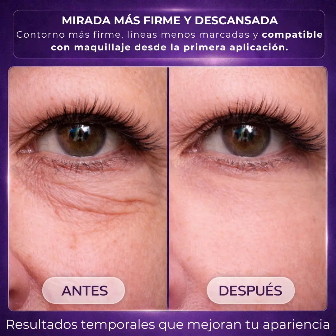 InstantLift™ | Efecto tensor para ojeras y bolsas en 5 minutos