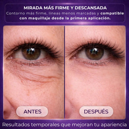 InstantLift™ | Efecto tensor para ojeras y bolsas en 5 minutos