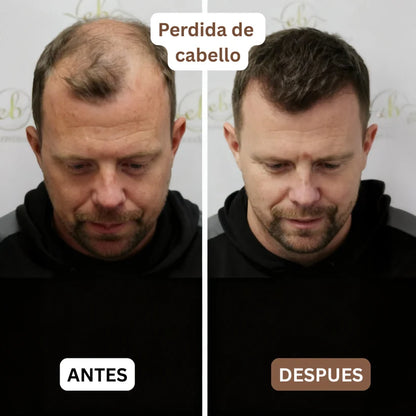 Multivitamínico de Órganos de Res VioNordic