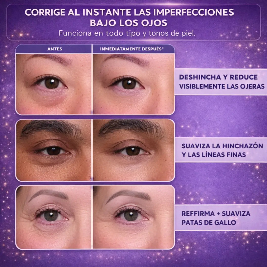 InstantLift™ | Efecto tensor para ojeras y bolsas en 5 minutos