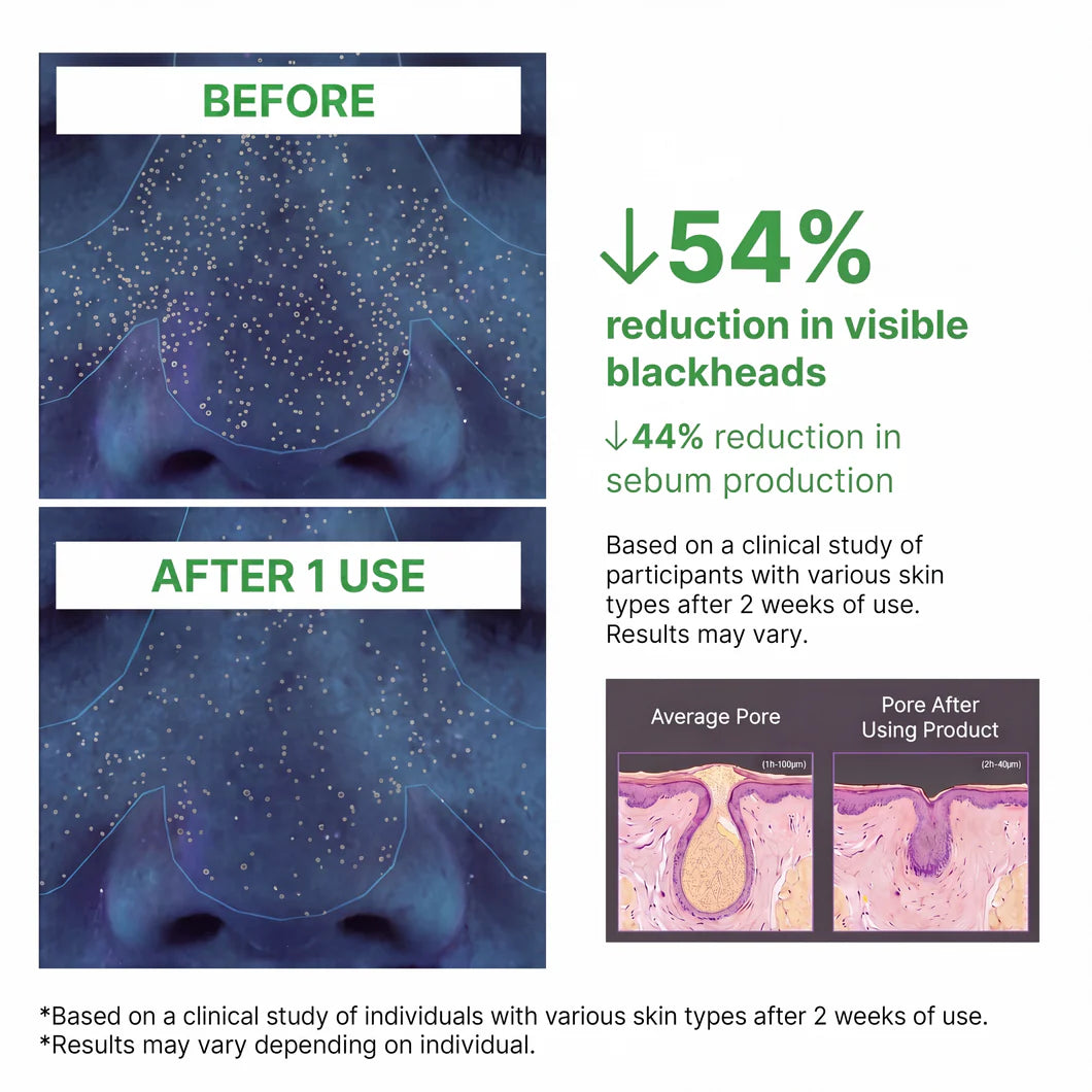 Amara Ganic™ Holy Basil Bubble Deep Mask